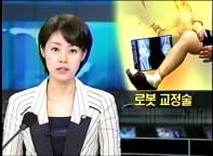 로봇 교정술 게시글의 1번째 첨부파일입니다.