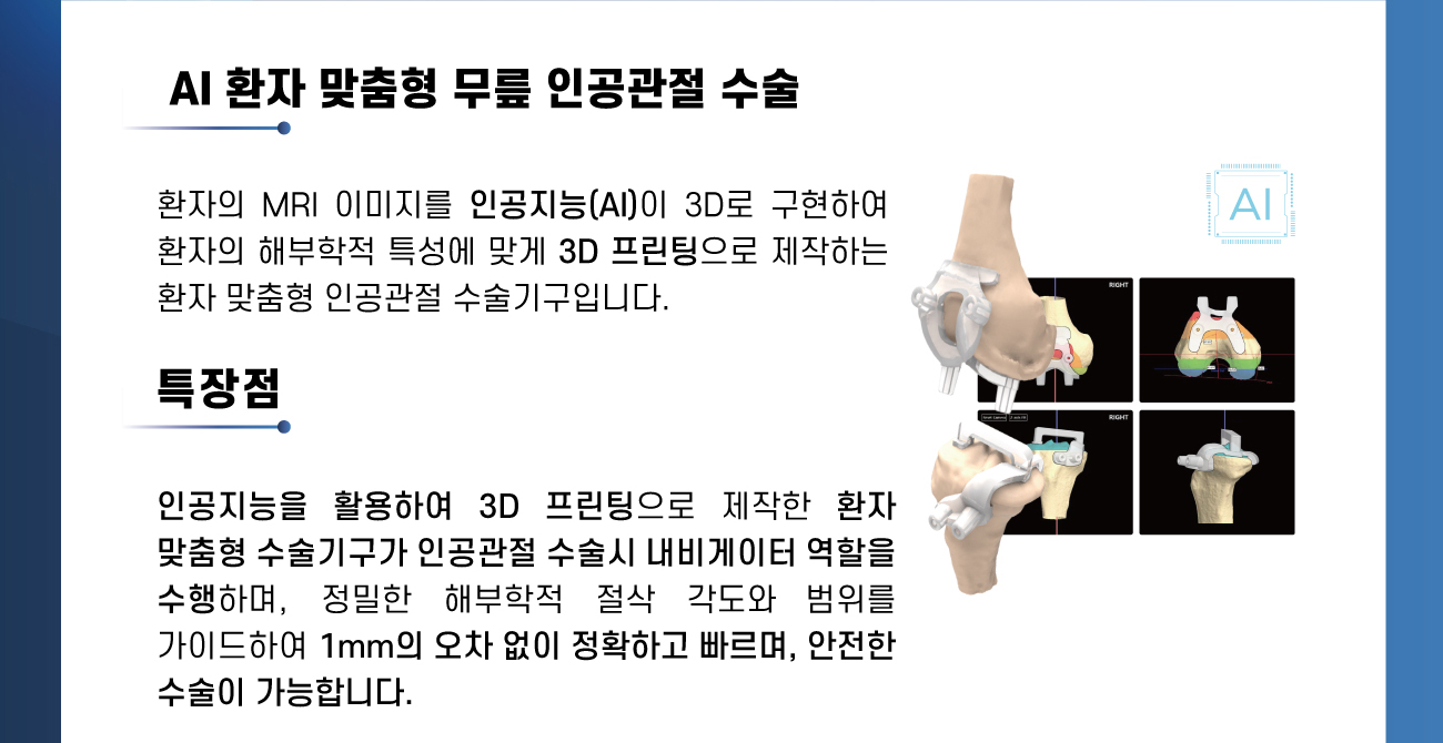 AI환자 맞춤형 무릎 인공관절 수술, 특장점, 