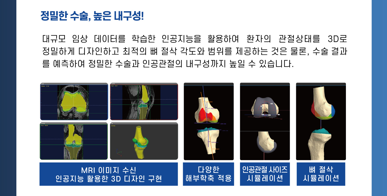 정밀한 수술, 높은 내구성!