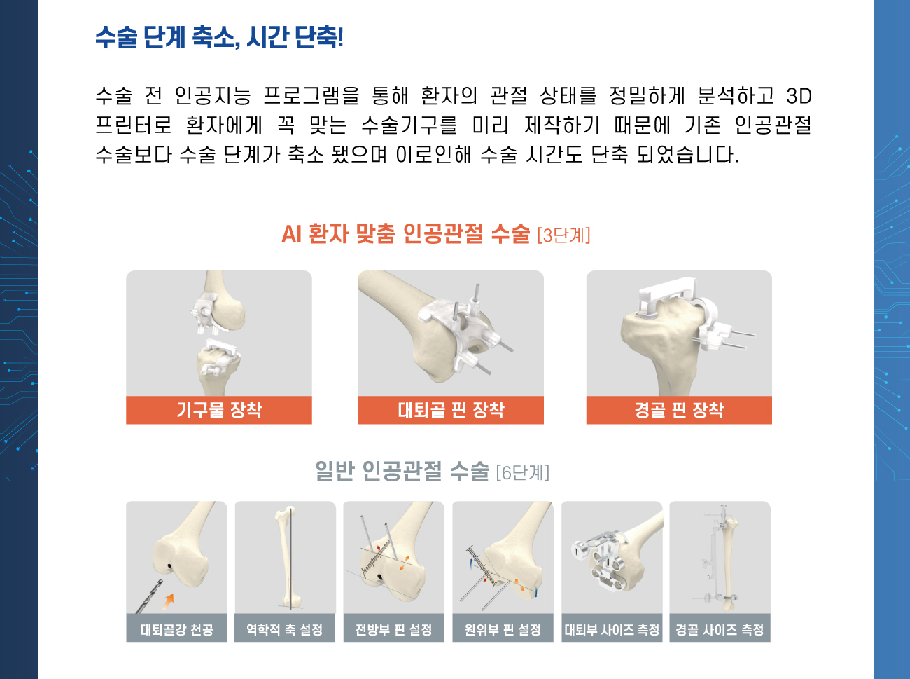 수술 단계 축소, 시간 단축!