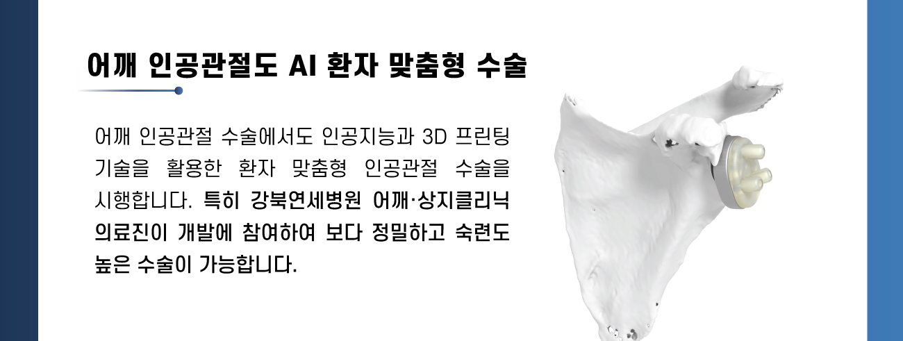어깨 인공관절도 AI 환자 맞춤형 수술