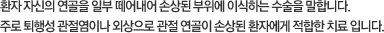 환자 자신의 연골을 일부 떼어내어 손상된 부위에 이식하는 수술을 말합니다. 주로 퇴행성 관절염이나 외상으로 관절 연골이 손상된 환자에게 적합한 치료 입니다.