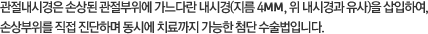 관절내시경은 손상된 관절부위에 가느다란 내시경()을 삽입하여, 손상부위를 직접 진단하며 동시에 치료까지 가능한 첨단 수술법입니다.