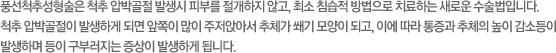 풍선척추성형술은 척추 압박골절 발생시 피부를 절개하지 않고, 최소 치;ㅁ습적 방법으로 치료하는 새로운 수술법입니다. 척추압박골절이 발생하게 되면 앞쪽이 많이 주저앉아서 추체가 쐐기 모양이 되고, 이에 따라 통증과 추체의 높이 감소등이 발생하며 등이 구부러지는 증상이 발생하게 됩니다.